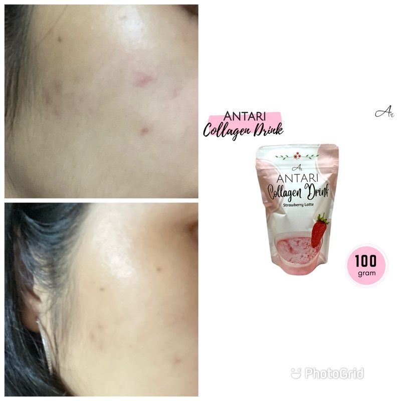 Antari Colagen ORIGONAL BPOM Nutrisi Vit C untuk Wajah Kulit dan Tubuh Anti Oksidan Menurunkan Berat Badan — foto 2