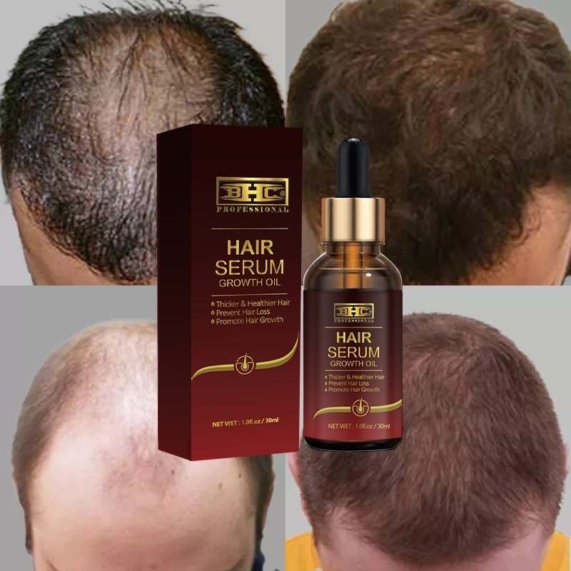 Serum Penumbuh Rambut Anti Botak HAIR SERUM / SERUM RAMBUT / HAIR GROWHT PENUMBUH RAMBUT BOTAK AMPUH ORIGINAL Hair Tonic Hair Tretmen Androgenetic alopecia — foto 2